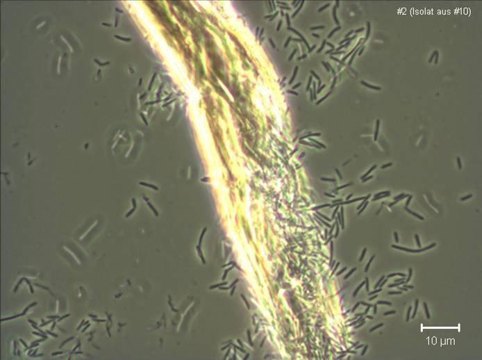 Vi khuẩn Clostridium thermocellum.