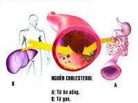 Có khá nhiều yếu tố ảnh hưởng đến hàm lượng cholesterol trong máu