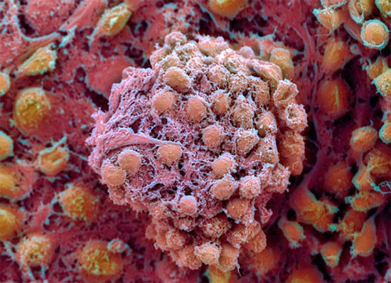 Lần đầu tiên tạo thành công tế bào gốc từ da người
