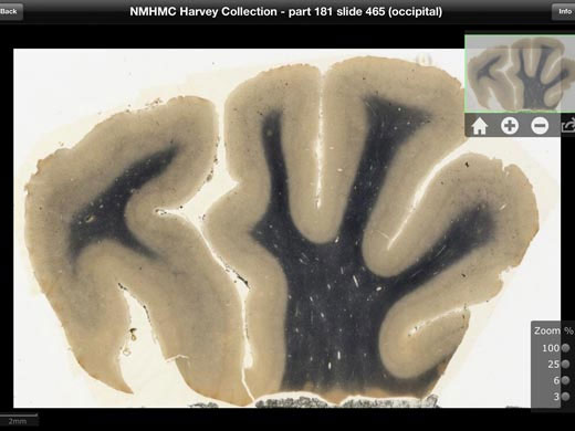 Một hình ảnh số hoá lát cắt não của nhà bác học thiên tài Einstein 