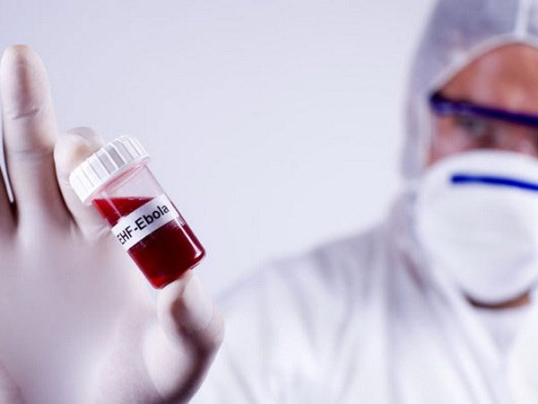Phát triển thành công kháng thể điều trị bệnh Ebola