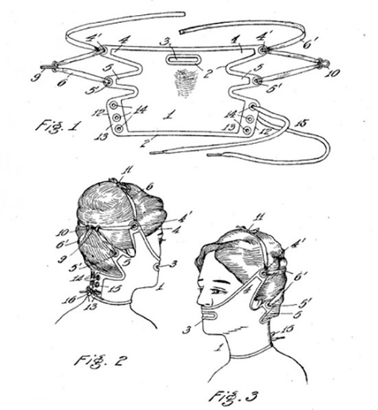 Mặt nạ giúp loại bỏ vết nhăn và chảy xệ Những dụng cụ làm đẹp "gây điên đảo" đầu thế kỷ 20