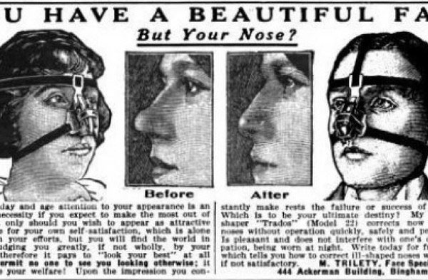 Mặt nạ nắn mũi Những dụng cụ làm đẹp "gây điên đảo" đầu thế kỷ 20