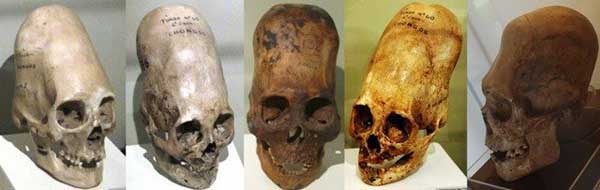 Hộp sọ bí ẩn Paracas không phải ADN của người