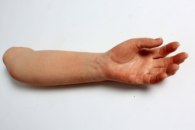 Những bộ phận cơ thể giả nhưng "thật" đến khó tin
