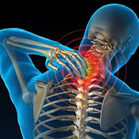 Thoái hóa đốt sống cổ Thoái hóa đốt sống cổ