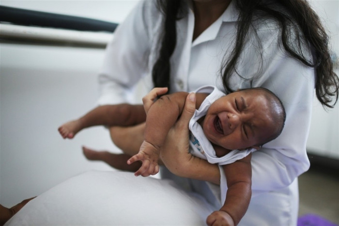 Virus Zika đang bị nghi ngờ là nguyên nhân gây hội chứng đầu nhỏ ở trẻ sơ sinh.