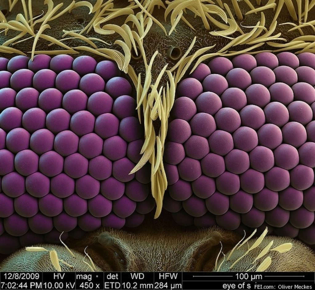 Đôi mắt của một con muỗi dưới kính hiển vi