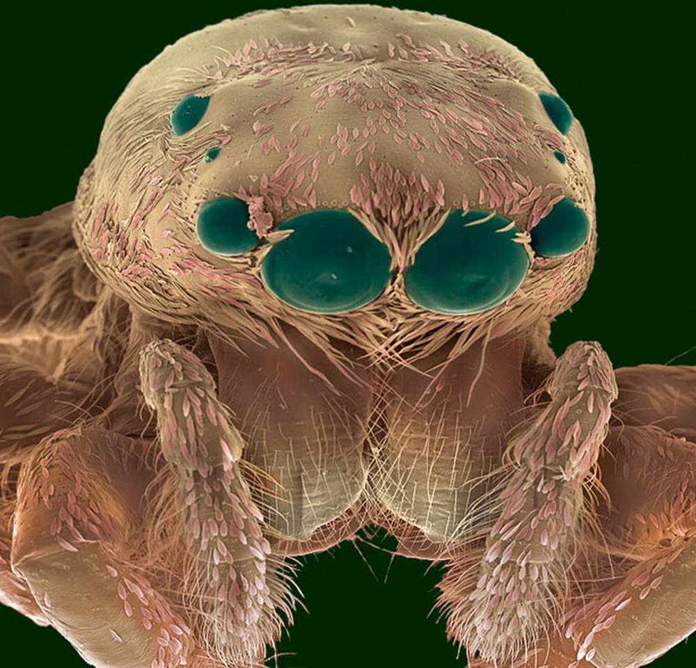 Một con nhện dưới kính hiển vi
