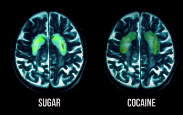 Não của bạn phản ứng với đường, giống như cách nó làm với cocaine