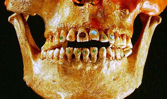Ngày nay, khoa học và công nghệ hiện đại cho phép con người làm đẹp răng bằng nhiều cách, ngay cả việc thay răng mới, trồng răng vàng, răng bạc.
