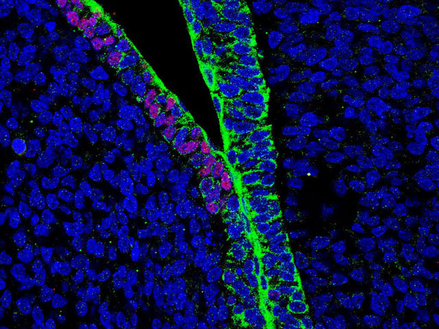 Các tế bào người màu xanh lá cây trong phôi thai chimera.
