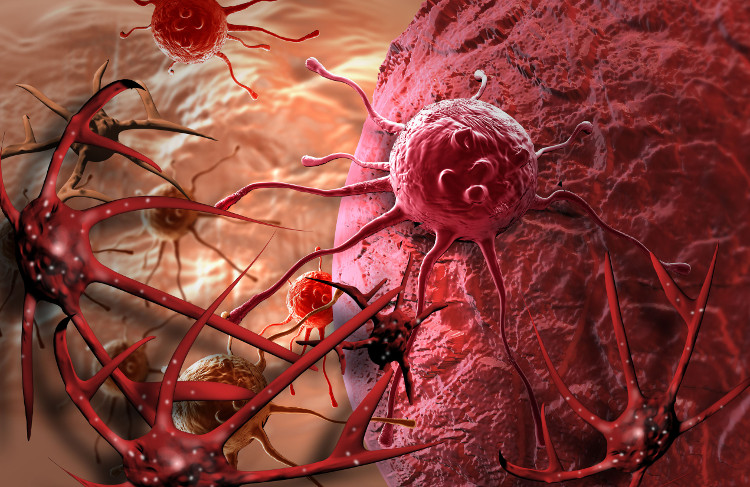 Các tế bào ung thư có thể di căn tới các phần khác của cơ thể thông qua đường máu và hệ bạch huyết.