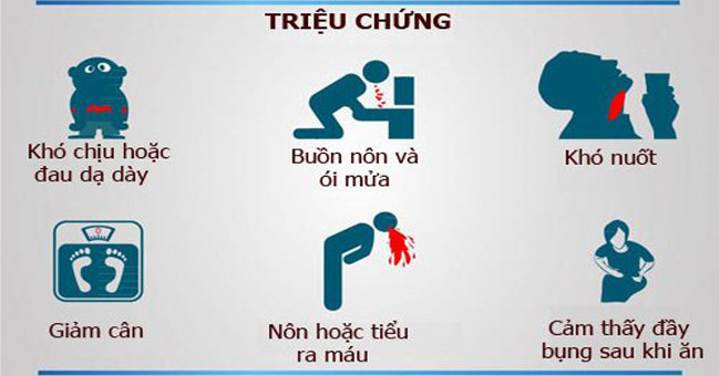 Dấu hiệu cảnh báo bạn bị ung thư dạ dày