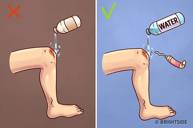 Rửa vết thương đúng cách là rửa bằng nước sạch hoặc nước đun sôi, rồi bôi thuốc mỡ lên vết thương. Rửa vết thương đúng cách là rửa bằng nước sạch hoặc nước đun sôi, rồi bôi thuốc mỡ lên vết thương.