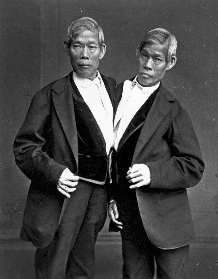 Hai anh em Chang và Eng.