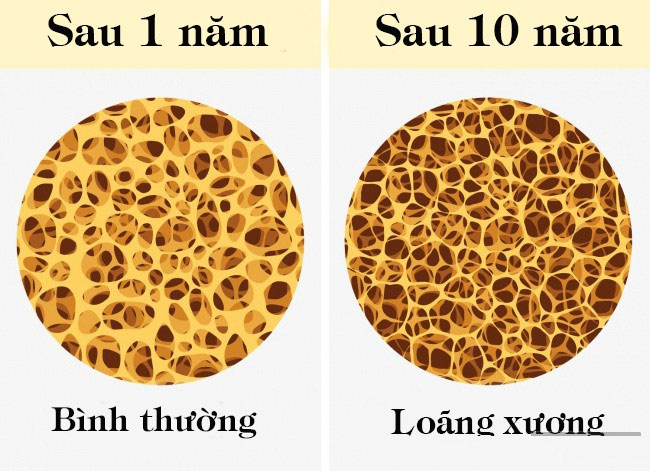 Cơ và xương thêm yếu đi