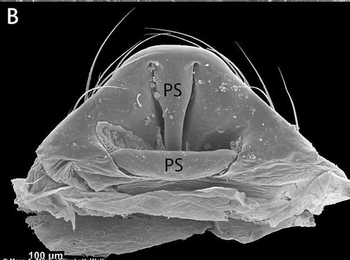 Cấu trúc cơ quan sinh sản bên ngoài của nhện cái