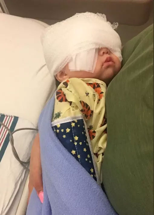 Mehlani phải phẫu thuật lúc năm tháng tuổi để tránh mù lòa.