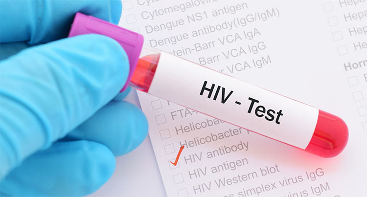 Gene mới phát hiện đưa đến hy vọng tạo ra một phác đồ chữa khỏi hoàn toàn HIV