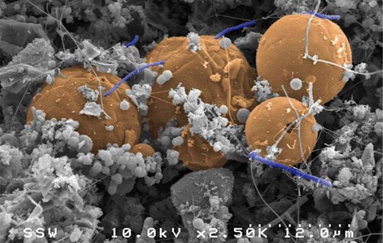 Tế bào hình que màu xanh và tím là một loài vi khuẩn sống trên phân tử khí hydro