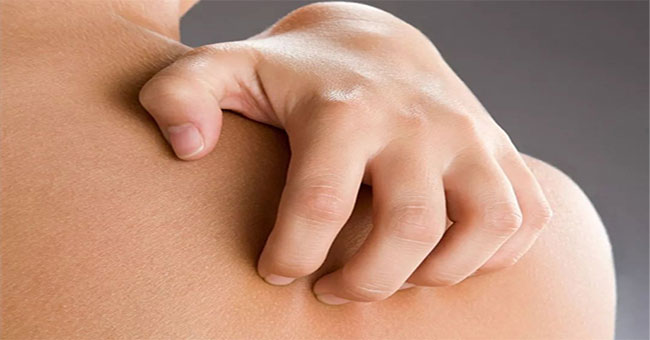 Vì sao sau khi tắm vào mùa đông hay bị ngứa?