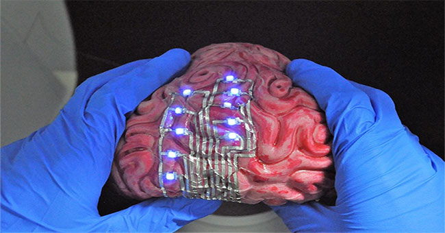 "Xăm" hình lên... não để điều trị bệnh, bước tiến mới của các nhà khoa học