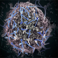 Lần đầu tiên phát hiện virus Ebola ký sinh trên dơi tại Tây Phi Lần đầu tiên phát hiện virus Ebola ký sinh trên dơi tại Tây Phi