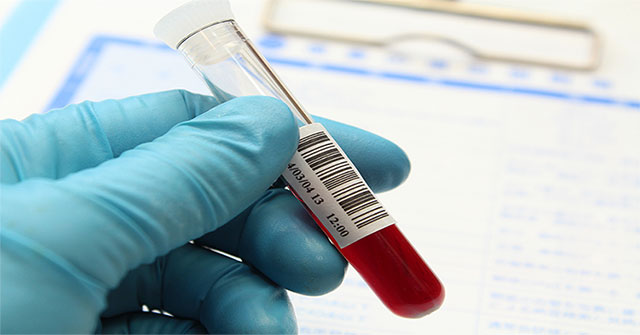 Mono trong xét nghiệm máu là gì?