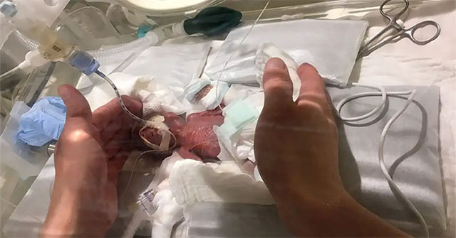 Cậu bé nhỏ nhất thế giới: 268g vẫn sống sót!