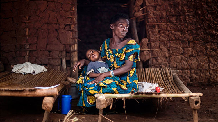 Trẻ em nhiễm sốt rét tại Muma, CHDC Congo.