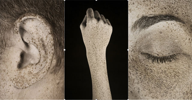 Tác hại của tia UV lên da qua ống kính nhiếp ảnh gia người Pháp