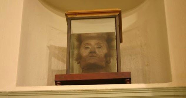 Đầu của nhà giải phẫu Antonio Scarpa.