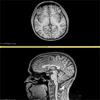 Tìm ra phương thức điều trị tốt nhất nhờ chuyển hình ảnh cắt lớp thành 3D Tìm ra phương thức điều trị tốt nhất nhờ chuyển hình ảnh cắt lớp thành 3D