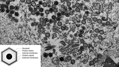 Hình ảnh qua kính hiển vi điện tử của tế bào lợn bị nhiễm virus ASF.