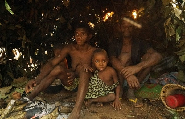Những đứa trẻ thuộc bộ lạc Baka thường hay mắc các bệnh về đường tiêu hoá.