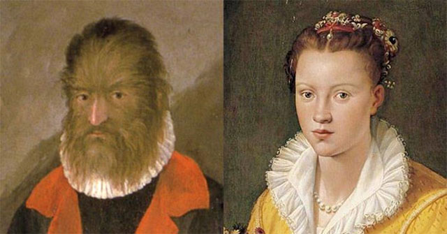 Bi kịch của "người sói" bị đối xử như thú vật