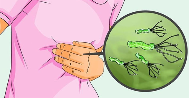 Khi nào vi khuẩn HP gây ung thư dạ dày?