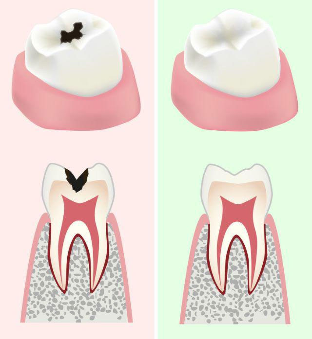 Cải thiện sức khỏe răng miệng