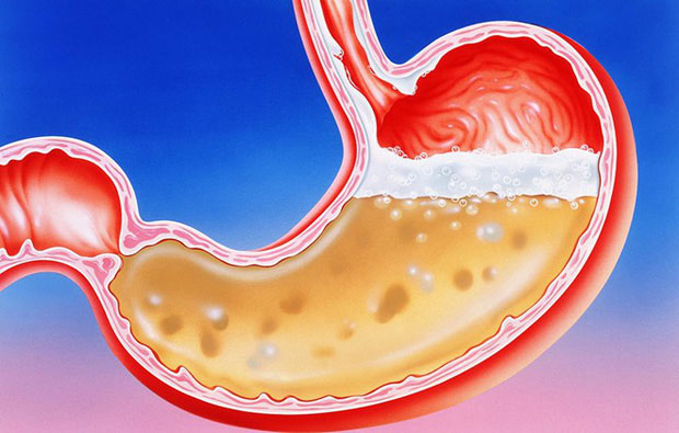 Tiếng ùng ục trong dạ dày