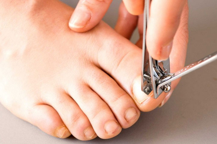 Cách làm đúng khi cắt móng chân, móng tay, đó là làm sao để tránh các vấn đề về chân.
