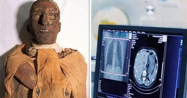 Vua Ramses III chết bởi vết cắt ở cổ.