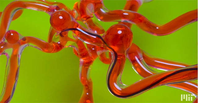 Robot mỏng như con giun, "bò" trong não để phá cục máu đông