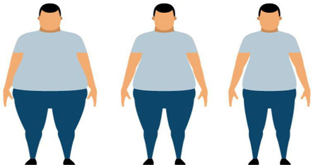 Hiểu về phẫu thuật giảm béo: Phương pháp cứu cánh cho những người thừa cân quá độ