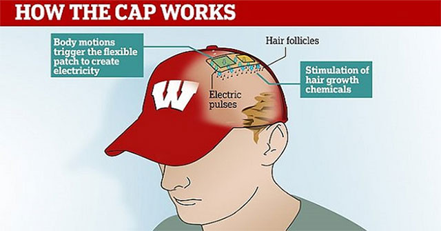 Các nhà khoa học phát triển thành công mũ chống hói đầu