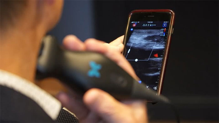 Thiết bị siêu âm cầm tay này đã được hàng nghìn bác sĩ ở Mỹ chọn sử dụng