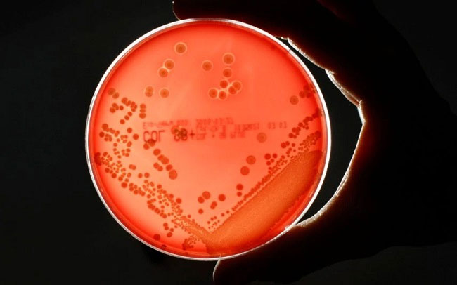 Các siêu vi khuẩn này là một trong những mối đe dọa lớn nhất đối với loài người