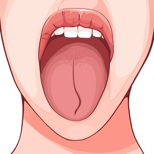 Một đường cong gần đầu lưỡi có thể chỉ ra các vấn đề ở vùng cổ tử cung. 