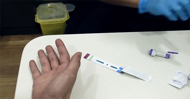 Que test HIV bị cắt sẽ làm sai lệch kết quả xét nghiệm