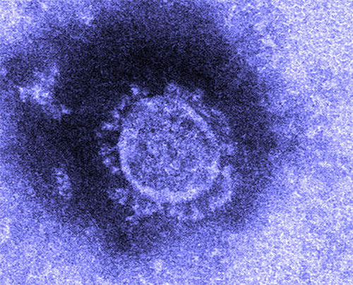 Nhật Bản đã cô lập thành công virus corona, mở đường cho việc tạo ra vắc xin chống lại virus này